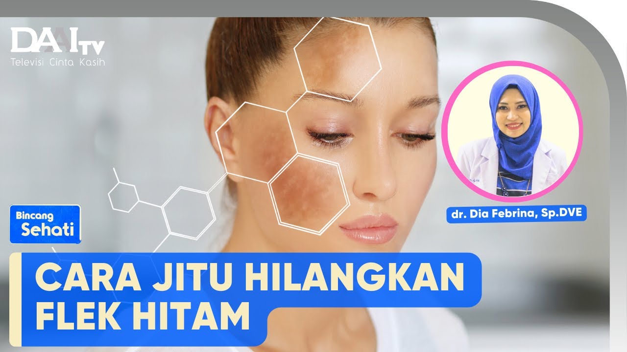 Cara Jitu Hilangkan Flek Hitam | Bincang Sehati