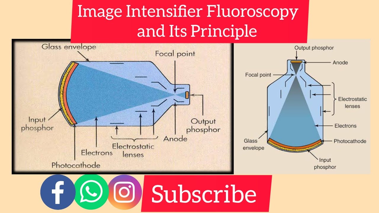 Image Intensifier Fluoroscopy | Principle Of Image Intensifier Fluoroscopy | By Aaqib Sir