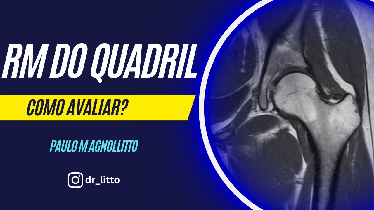 RM DO QUADRIL: COMO AVALIAR?