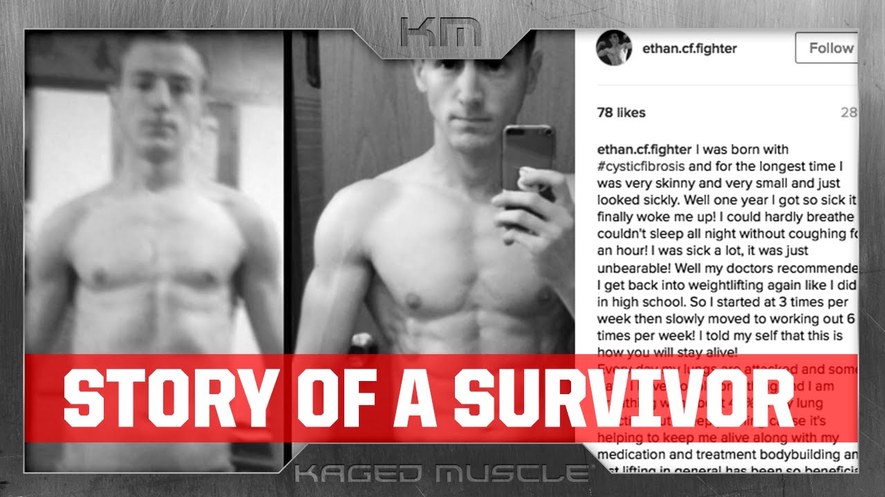 STORY OF A CYSTIC FIBROSIS SURVIVER | ETHAN CRANE