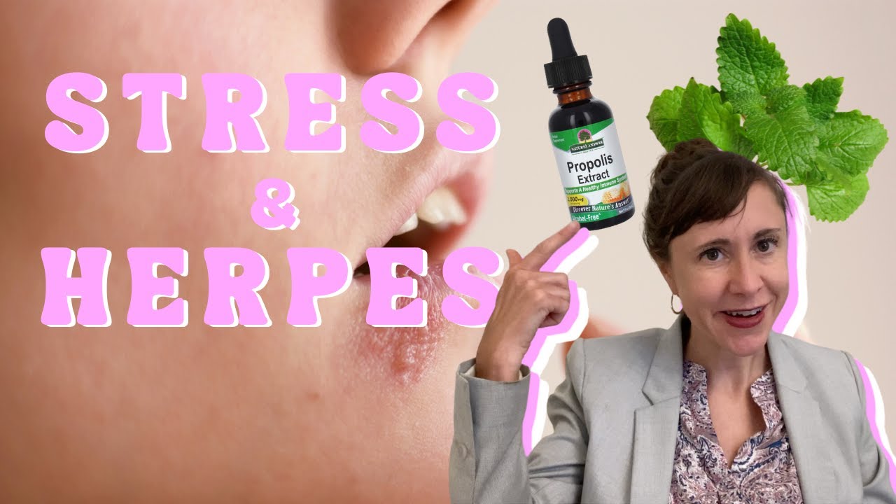 Herpes Outbreaks | Natural Remedies & Treatments