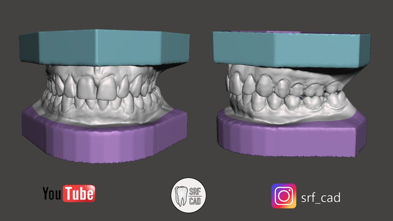MESHMIXER DENTAL ORTHO TWEED: как прикрепить ортодонтическое основание к внутриротовому файлу STL...