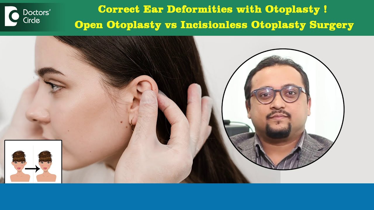 How to correct EAR SHAPE? Open Otoplasty vs Incisionless Surgery- Dr.Vybhav Deraje | Doctors' Circle