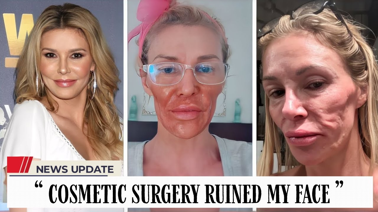 10 Famous Celebrities Who Completely Ruined Their Faces With Plastic Surgery -  Then and Now 2026