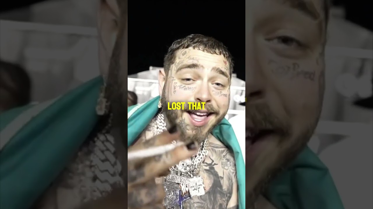 Post Malone LOST a $600,000 Diamond Tooth 🤯