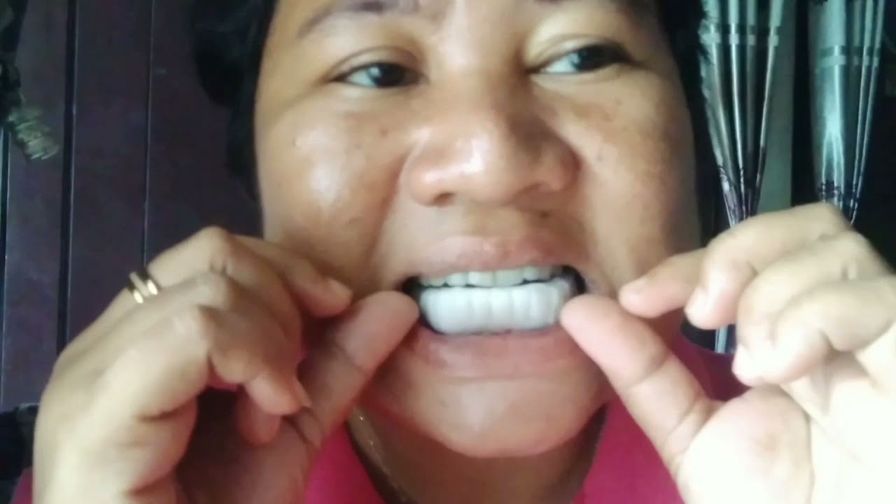 CARA PAKAI SNAP ON SMILE VINER GIGI PALSU (UNBOXING)