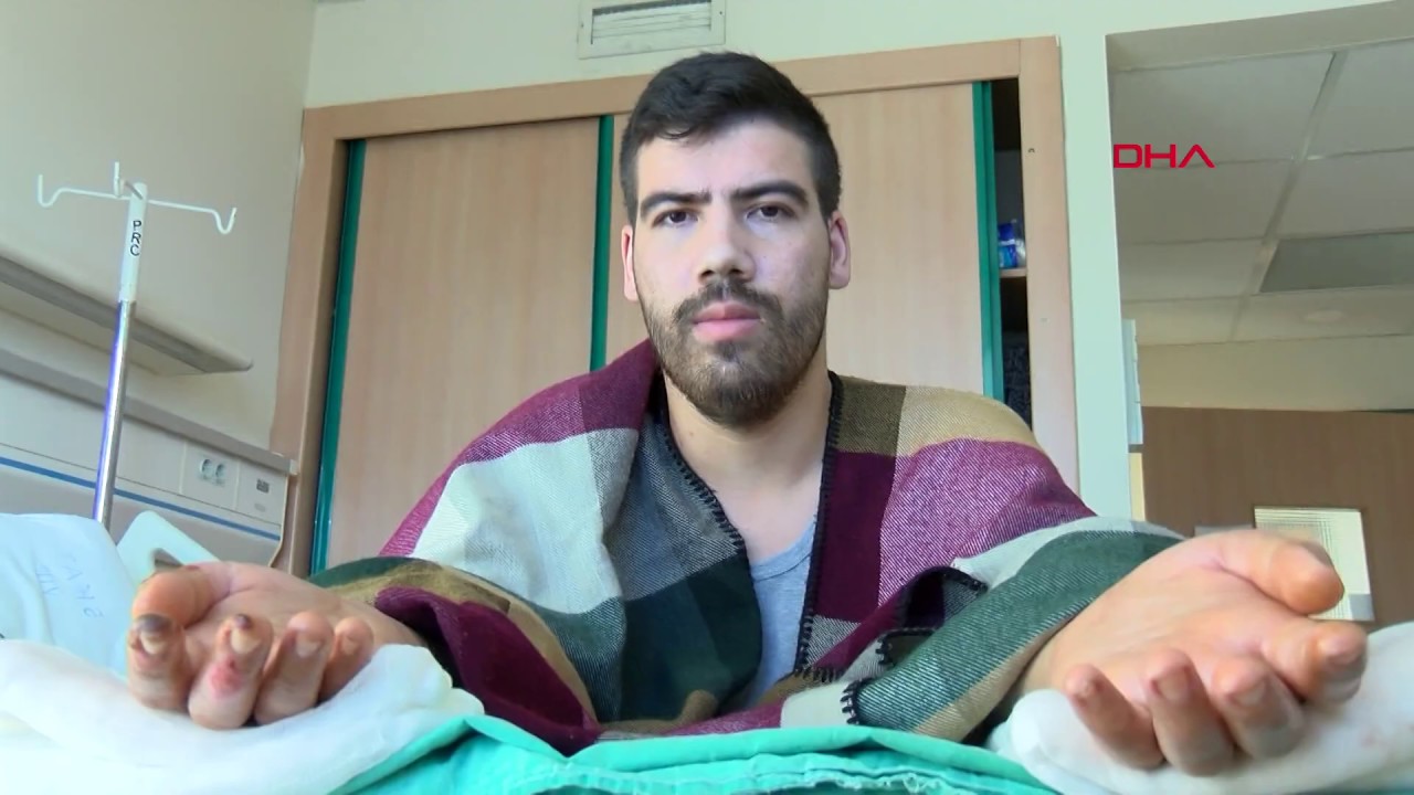 Çift kol nakilli Yusuf Oğuz'un tırnakları uzamaya başladı