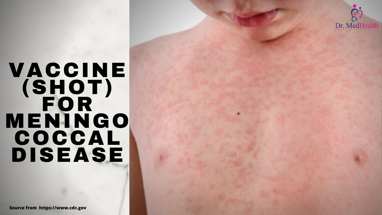 Meningococcal disease Vaccine |How many meningococcal vaccines are required?