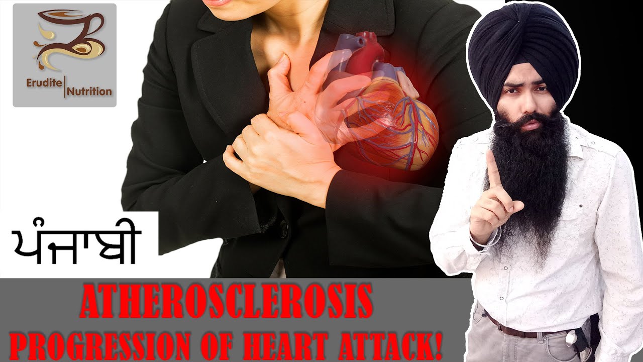 Atherosclerosis - Coronary Artery Disease (CAD) Progression Explained!! (Punjabi)