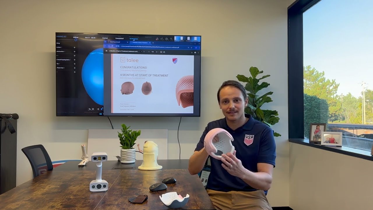 The Talee Cranial Remolding Helmet