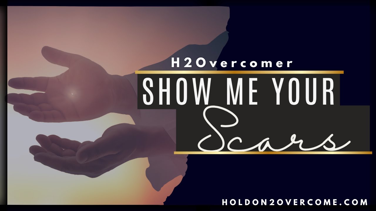 Show Me Your Scars