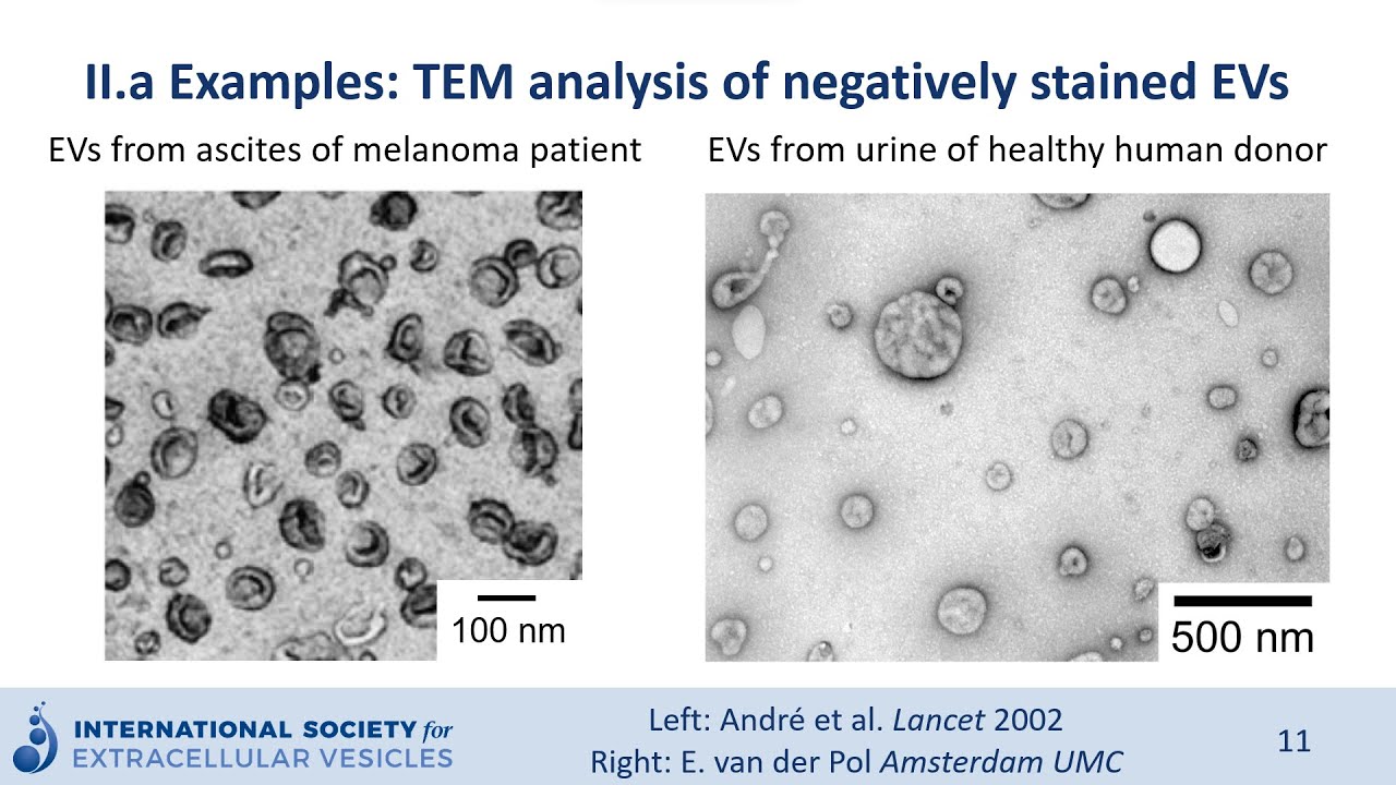Electron microscopy of extracellular vesicles