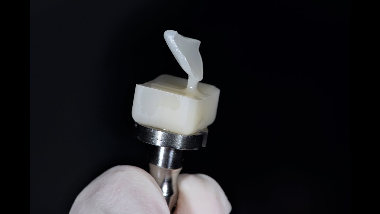 Ceramic veneer ,, Digital Workflow