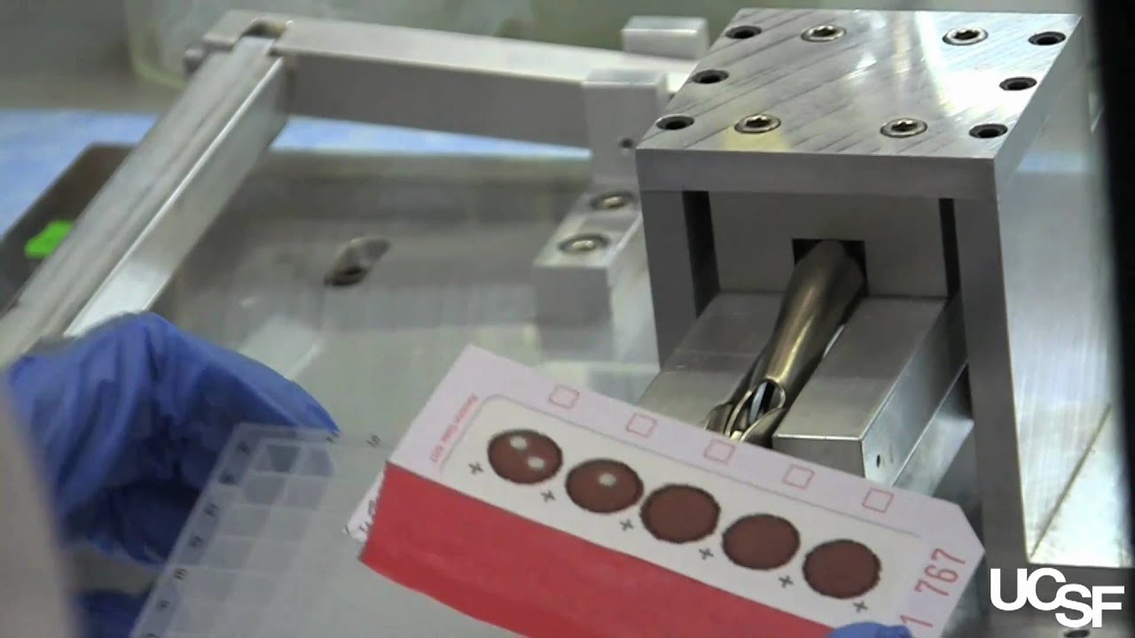 California Screens Newborns for Deadly Immune System Disease