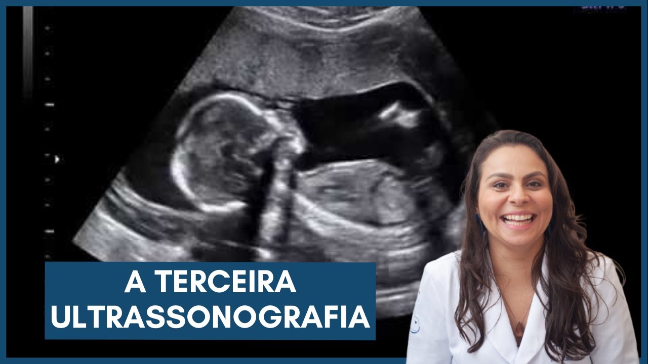 A terceira ultrassonografia - Dra. Maíra de La Rocque