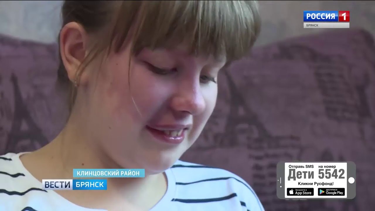 Настя Быконя, 11 лет, мальформация кровеносных сосудов лица и слизистой нёба