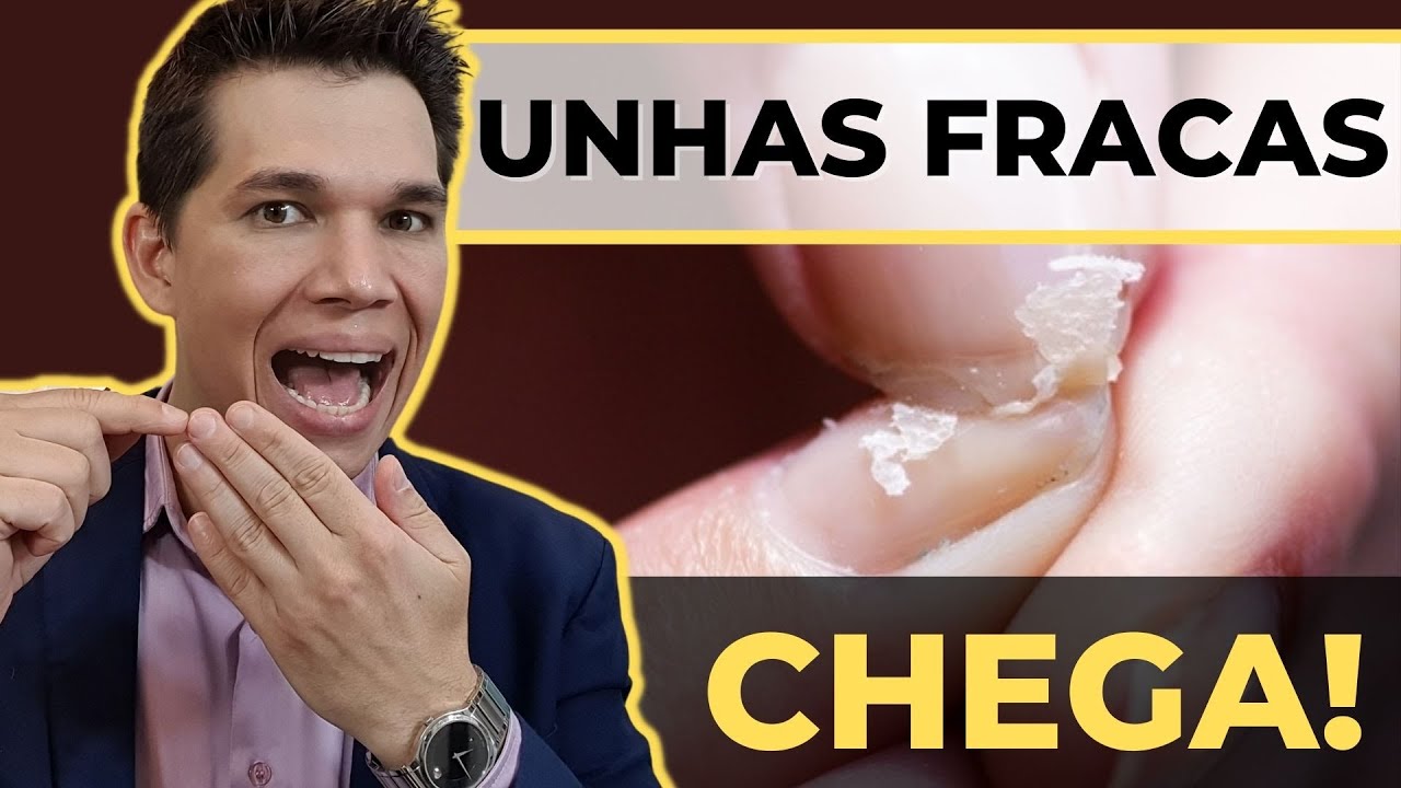 Tenha UNHAS GRANDES e FORTES: Receita Caseira