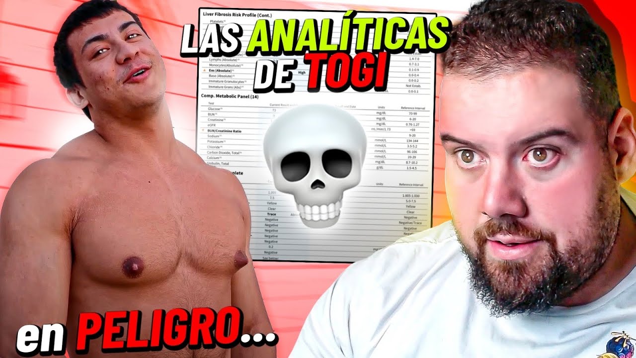 TOGI ENSEÑA SUS ANALÍTICAS Y ESTÁ EN PELIGRO