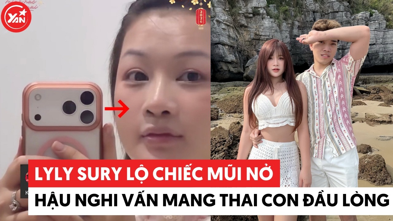 Lyly Sury lộ chiếc mũi nở hậu nghi vấn mang thai con đầu lòng #lylysury