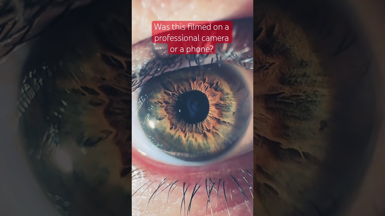 Iris Shot - iPhone 17 Pro Max Vs Professional Camera