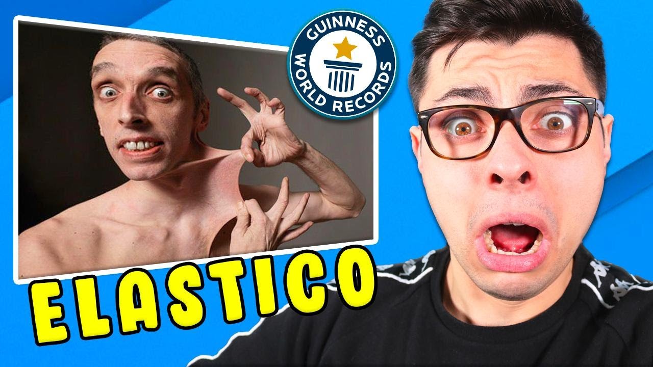 Conosciamo L'Uomo Con La Pelle ELASTICA ✋🏻