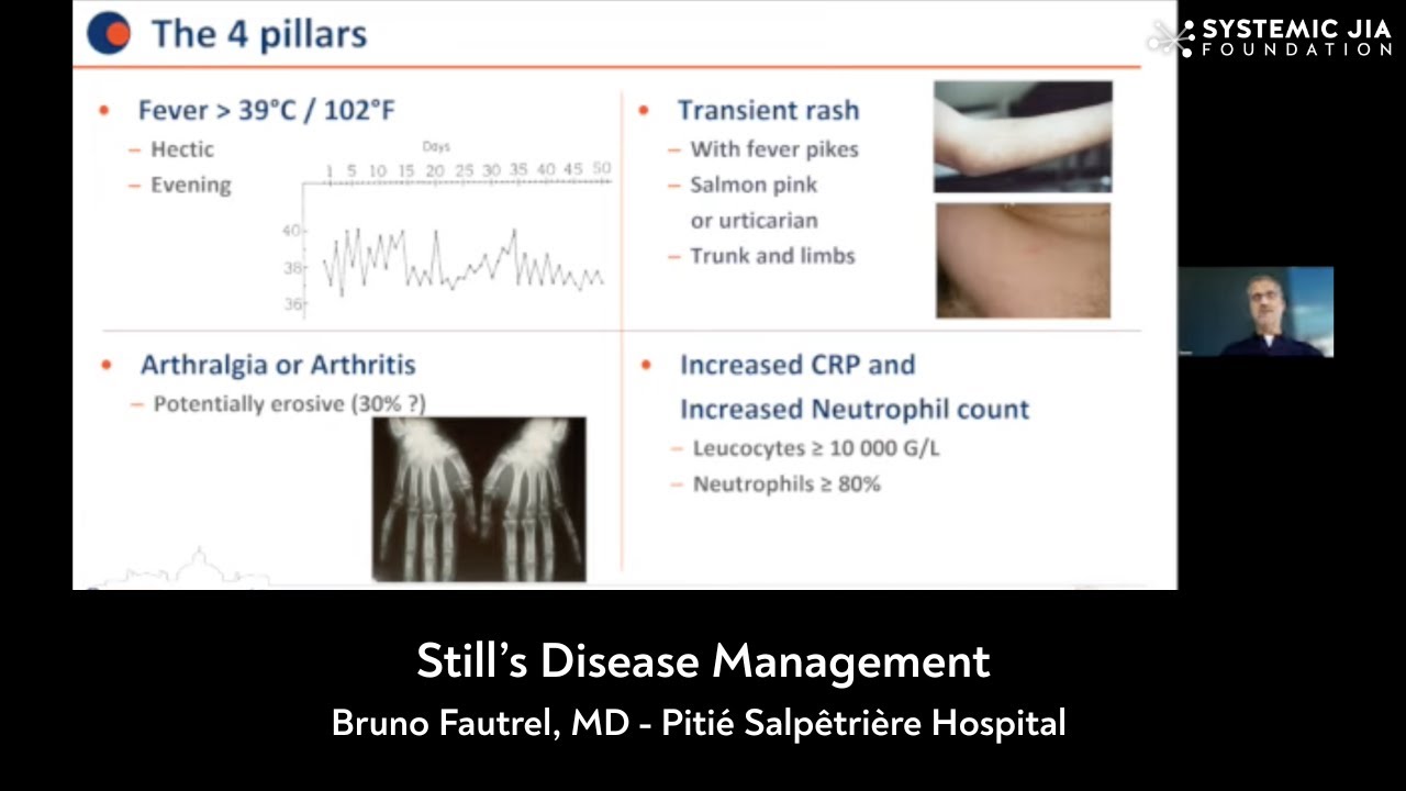 Still's Disease Management