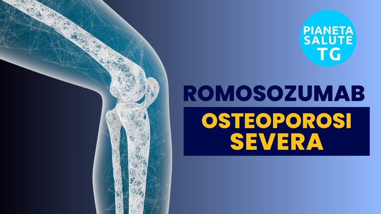 Romosozumab, novità per l'osteoporosi severa post-menopausale