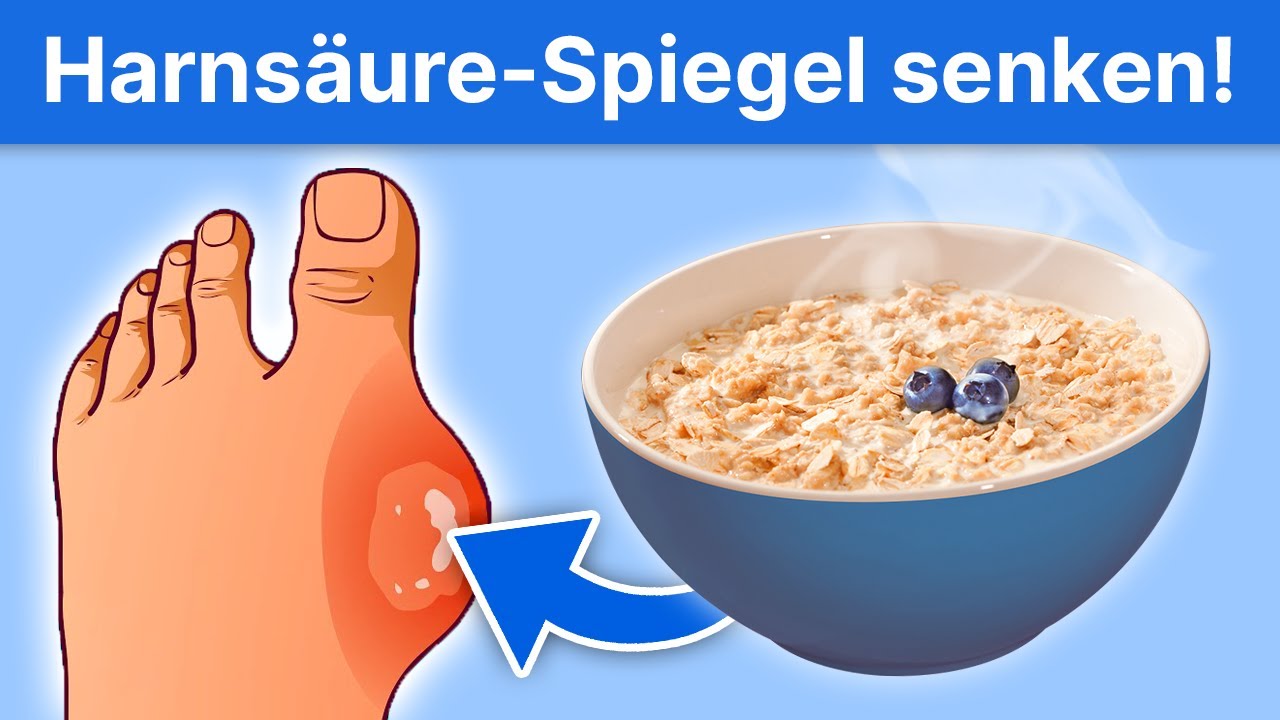 4 Lebensmittel, die deinen Harns&auml;urespiegel senken!