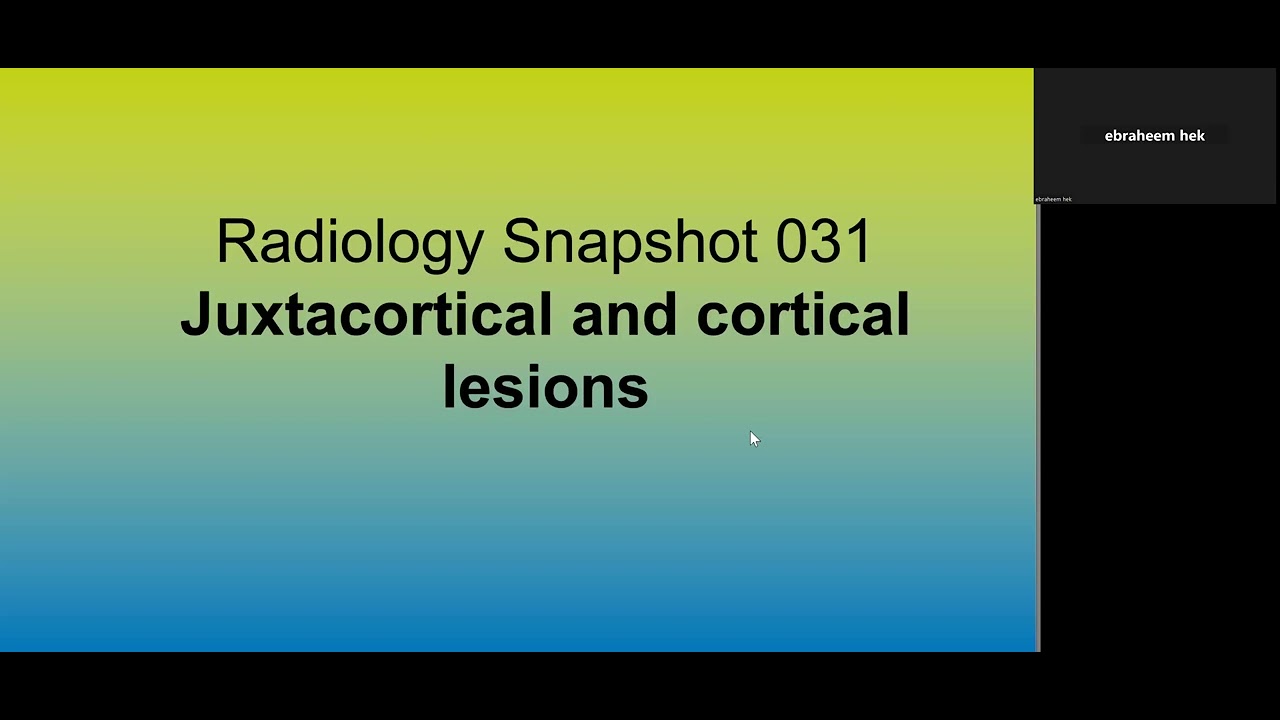 Juxtacortical and cortical lesions