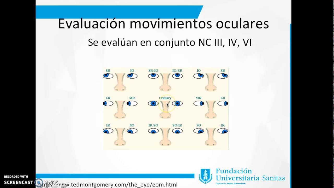 Lesi&oacute;n del nervio troclear