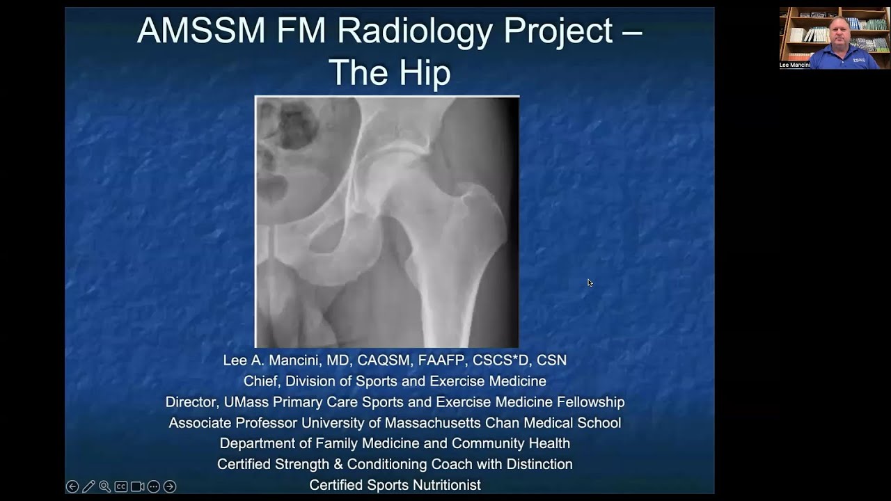The Hip | MSK Radiology: X-Ray Educational Modules for Primary Care Residents