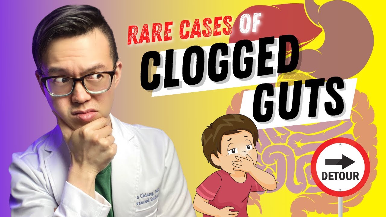Nausea and vomiting from BLOCKED INTESTINE | Gut Health