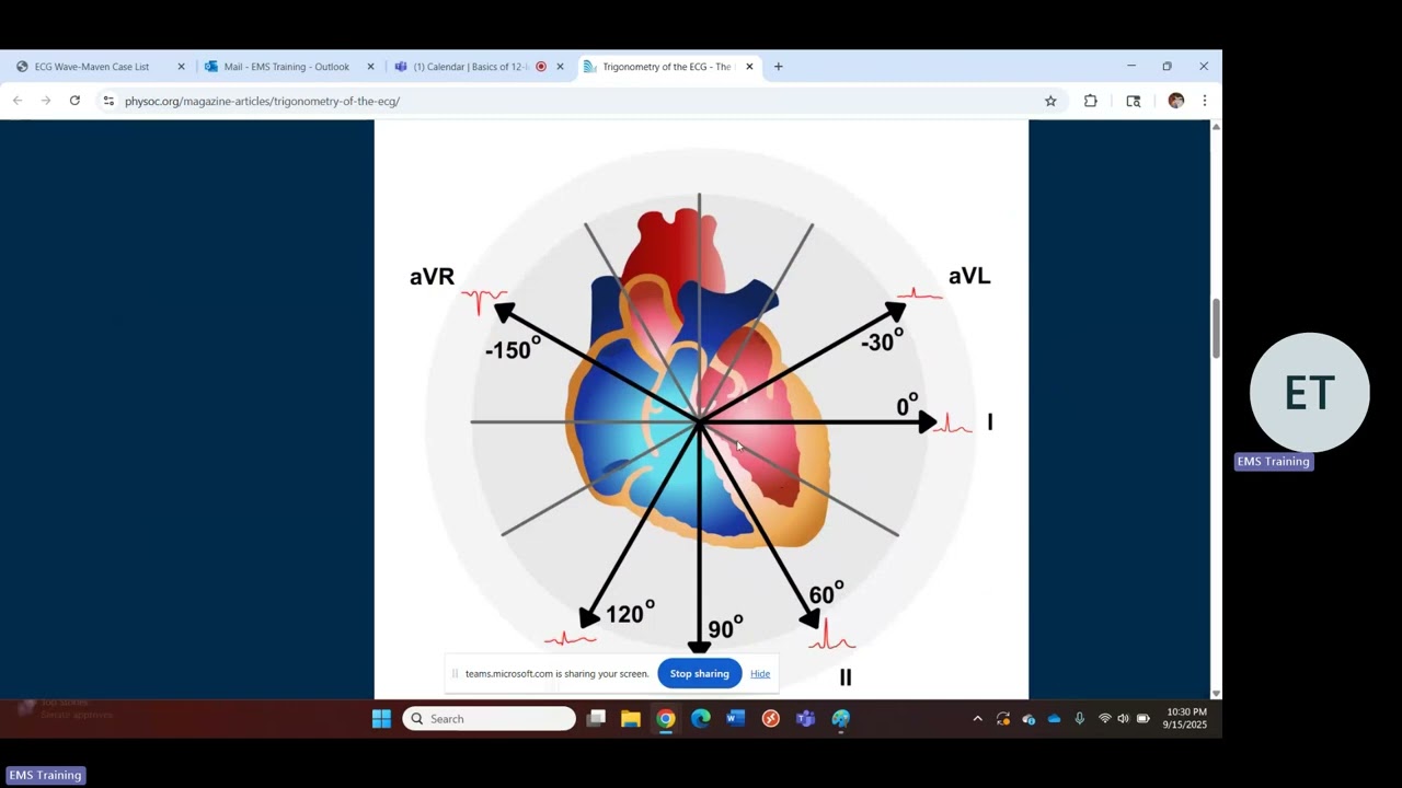 Basics of 12 leads