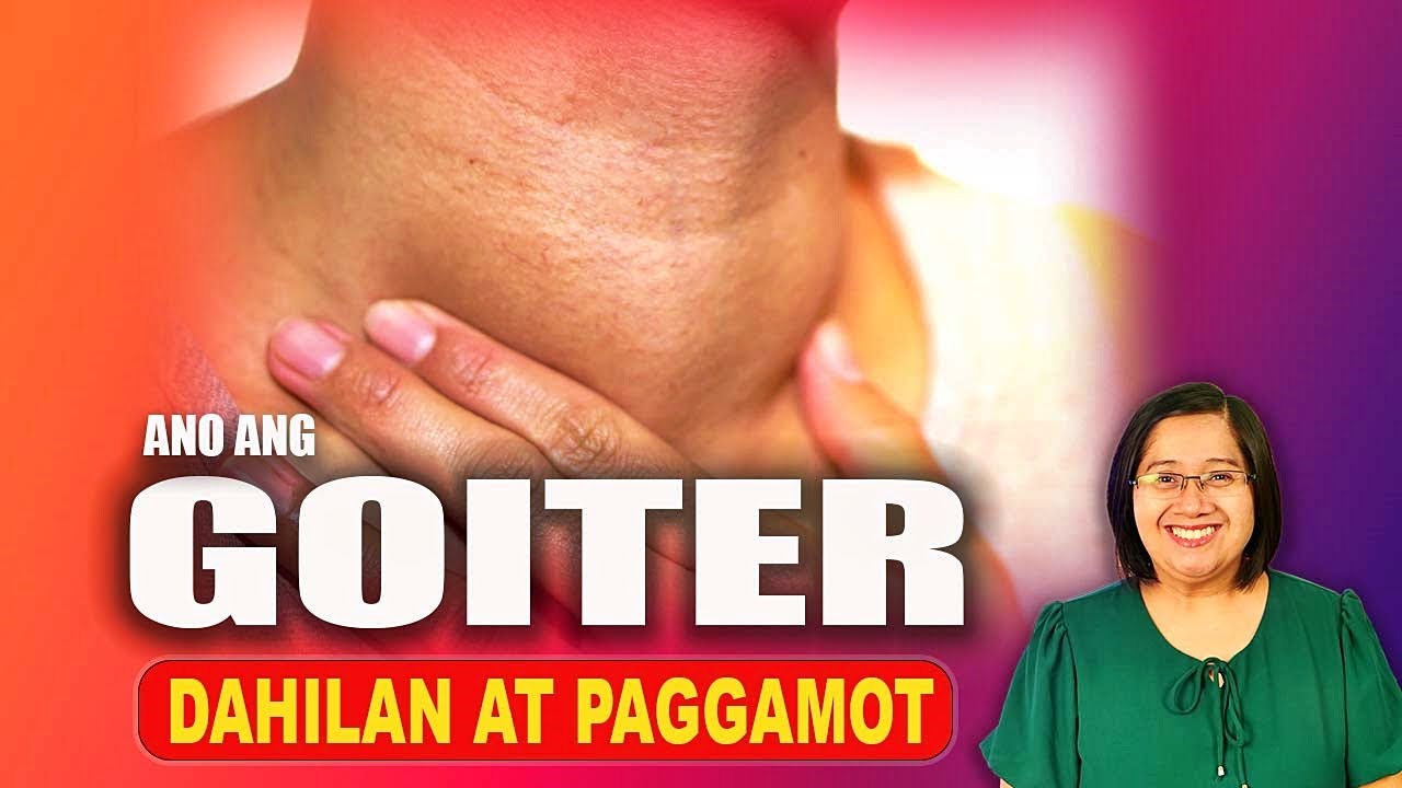 Bakit nagkaka GOITER (Thyroid Disease) at mga SINTOMAS ~ Tagalog Health Tips | Nurse Dianne