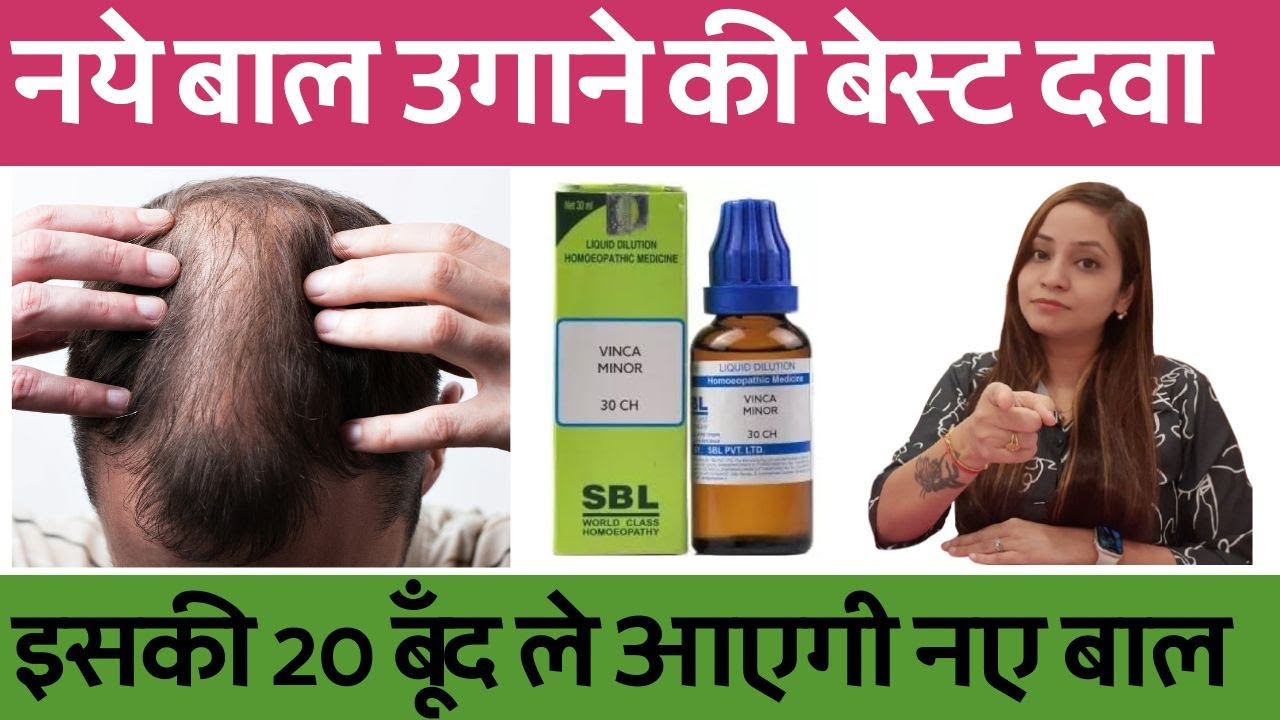 नये बाल उगाने के लिए बेस्ट होमियोपैथी दवा | hair growth homeopathy treatment and medicines