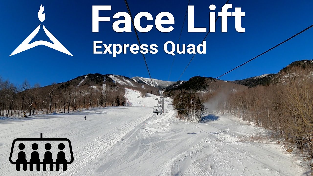 Whiteface Mountain - Face Lift