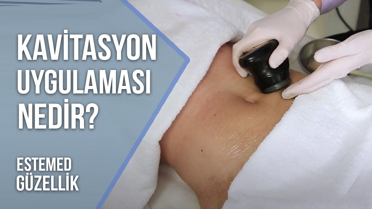 KAVİTASYON NEDİR? | SON DÖNEMİN MODASI | Estemed Bilgilendiriyor!