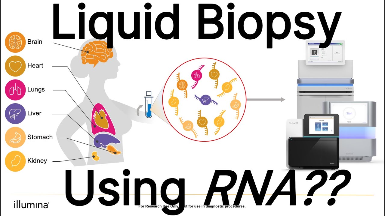 Advancements in Translational Biomarker Identification from Cell-Free RNA