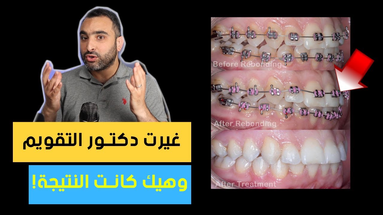 التقويم متركب غلط 😭... ما هو الحل ؟؟  | د.محمد صادقلي