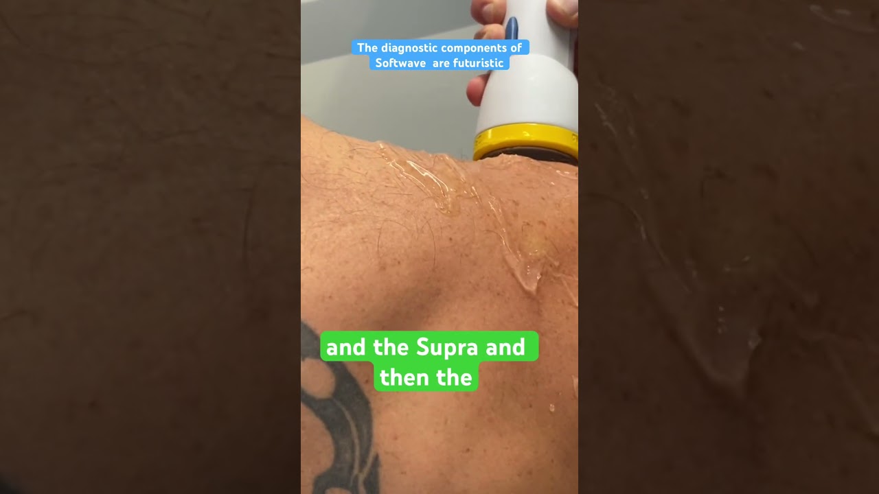 Dr Joel Baumgartner is surgical with Softwave #4thepatient #frozenshoulder #naturalrelief