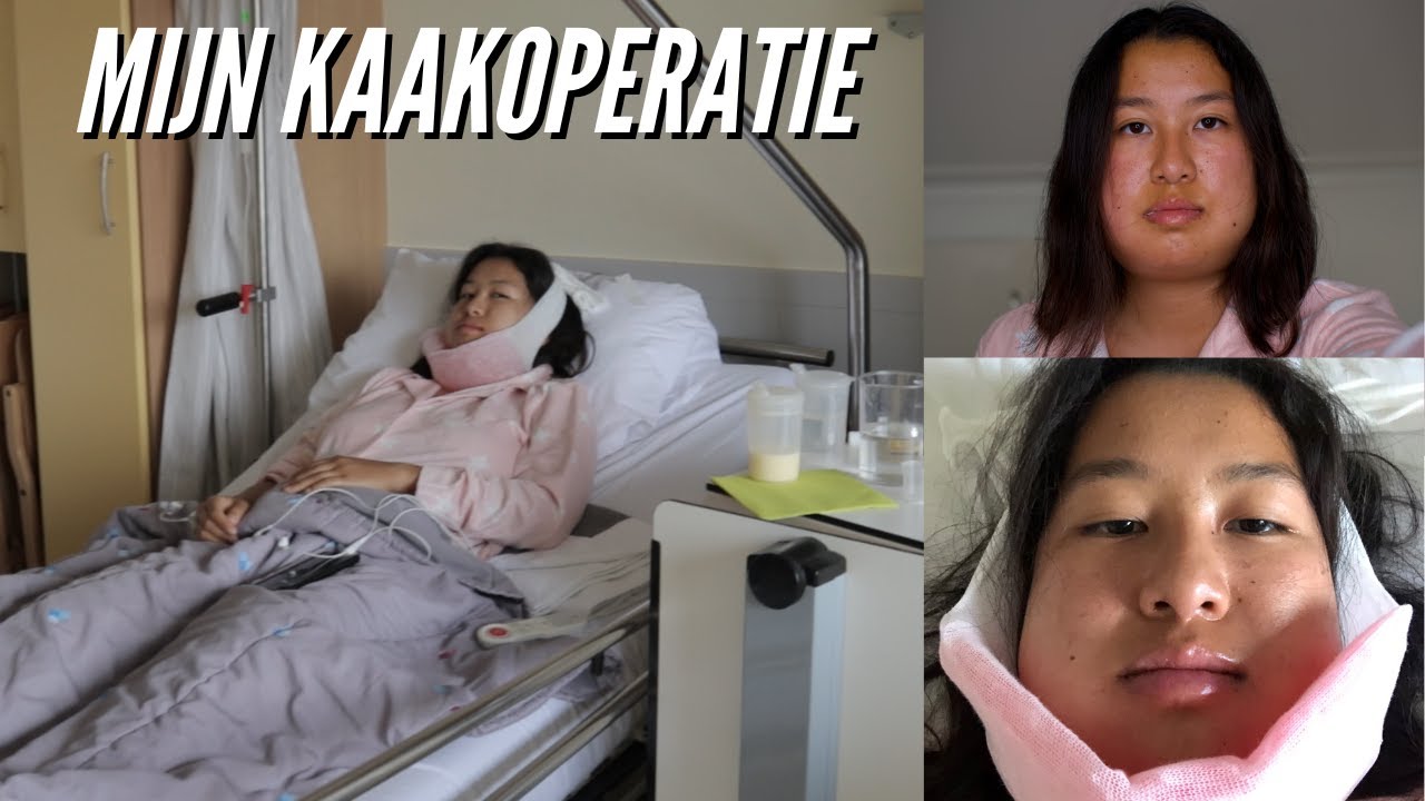 Mijn Kaakoperatie + 1 Week Herstel Erna 🏥 (Deel 1/2)