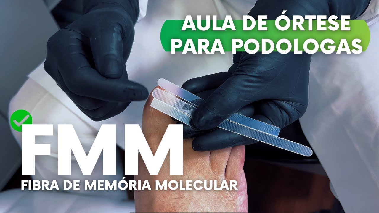Tipos de Fibras de Memória Molecular e Quais Usar | #ortese #podologia #aulagratuita
