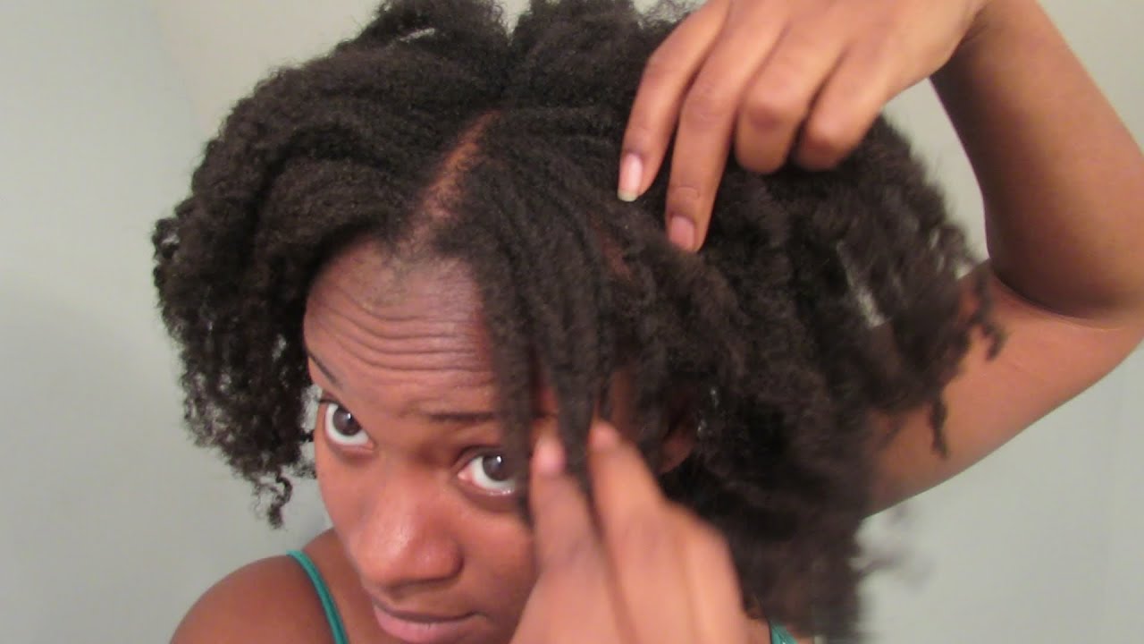 Thinning Hair vs Alopecia Update [requested]