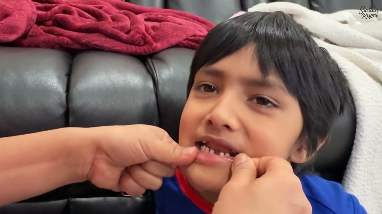 Pulling up his second teeth 🦷 
