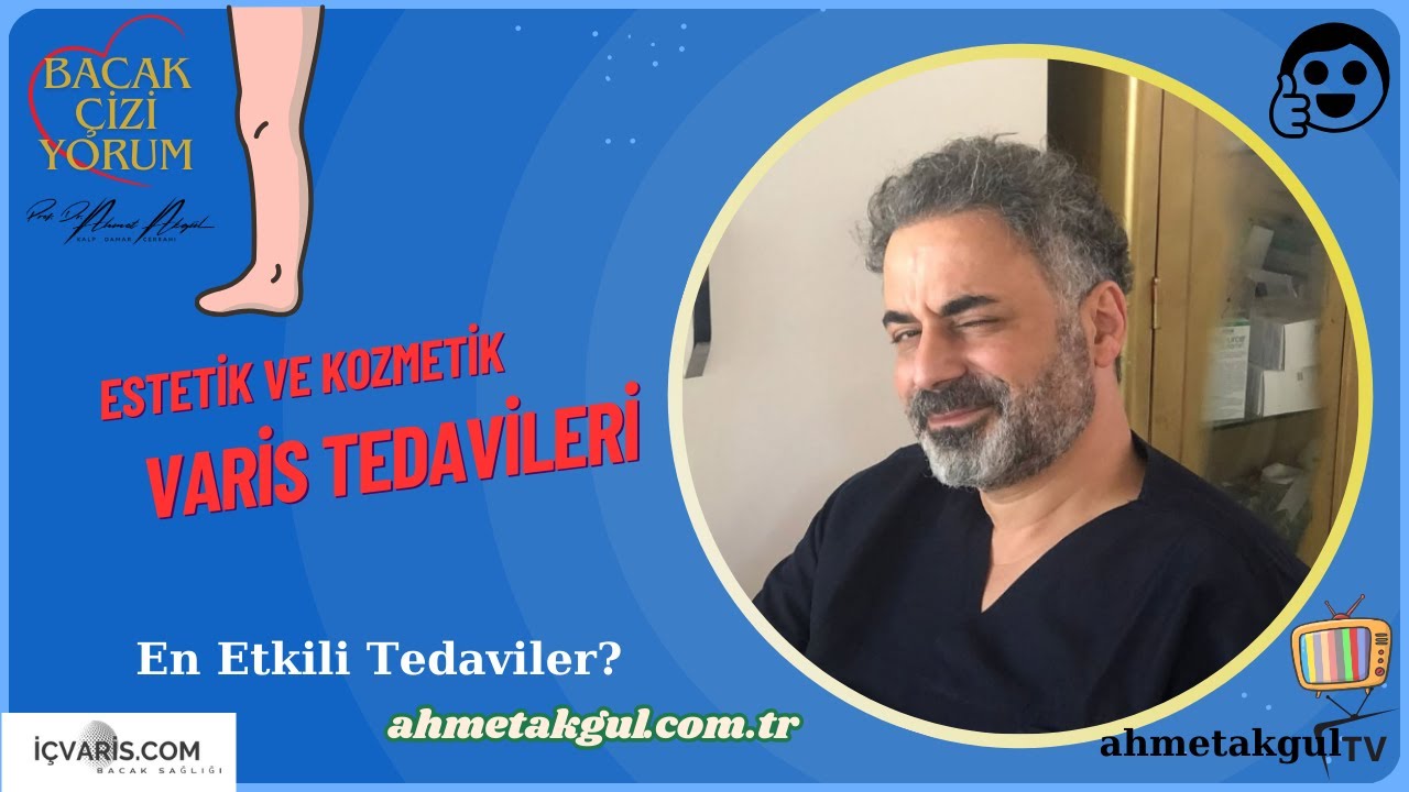 Modern Estetik Varis Tedavileri: İğne, Köpük, Skleroterapi, Radyofrekans ve Lazer - Dr. Ahmet AKGUL