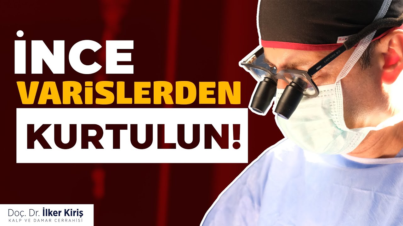 İnce Varislerin Tedavisinde Kullanılan 3 Yöntem | Doç. Dr. İlker Kiriş