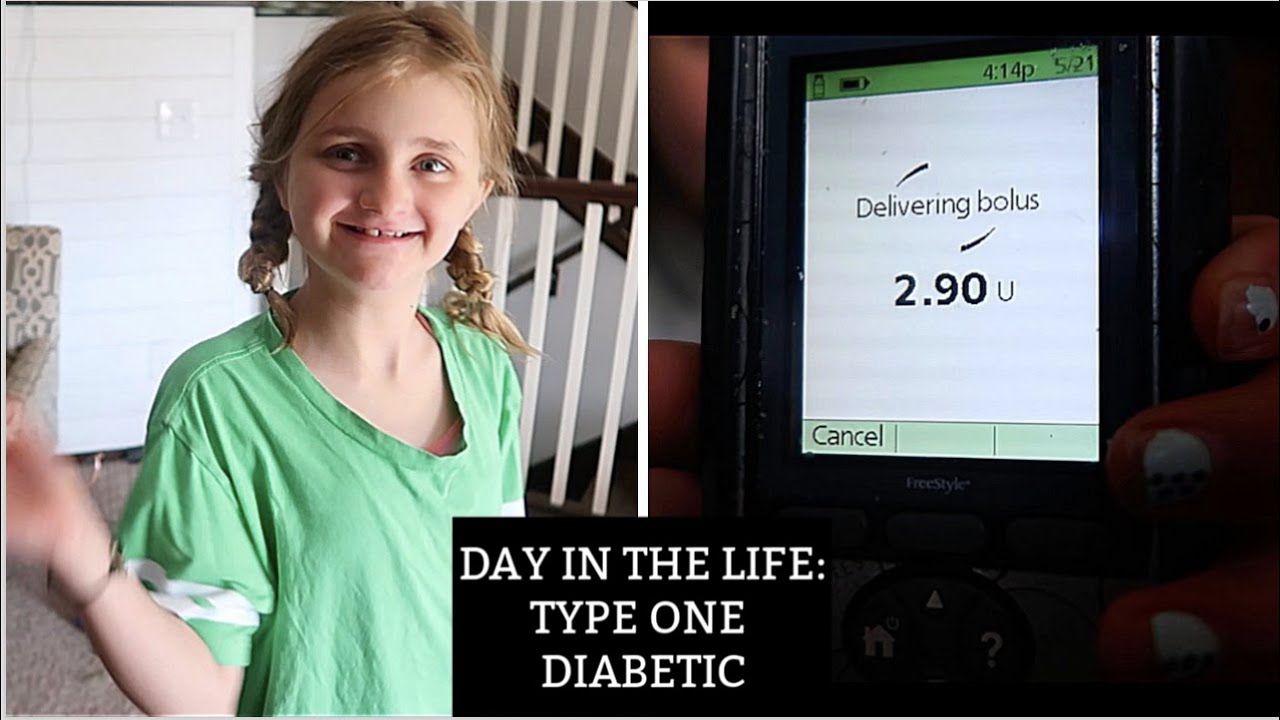 DAY IN THE LIFE OF A TYPE ONE DIABETIC | CELIAC | GF