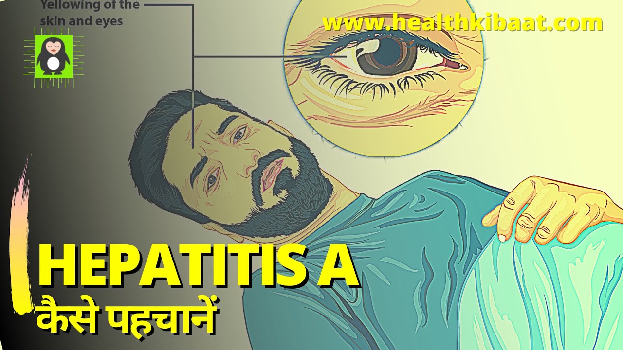 Hepatitis a in hindiIhepatitis a symptoms and treatment in hindi