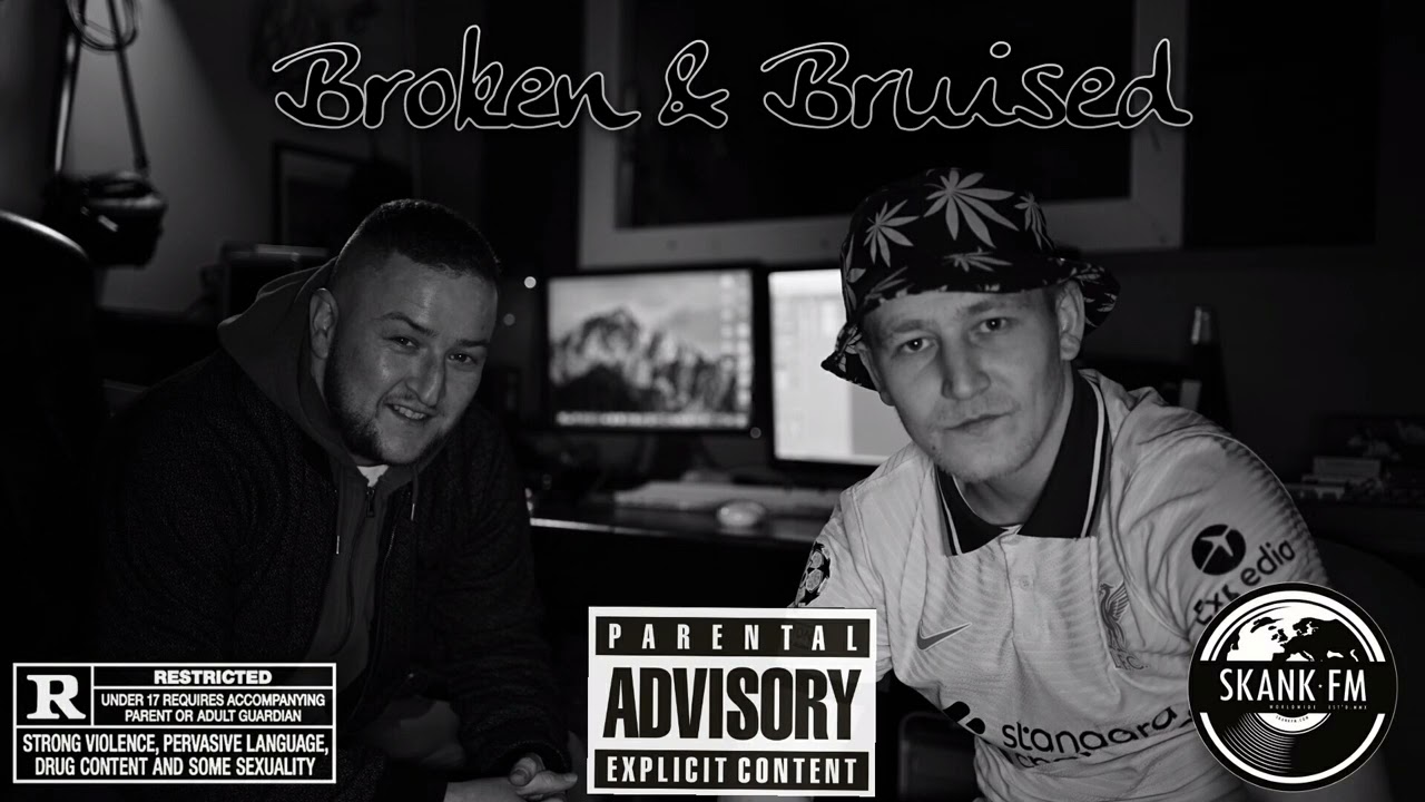 Durty Devz - Broken & Bruised Ft Daz (Official Audio) #irishhiphop #hiphop