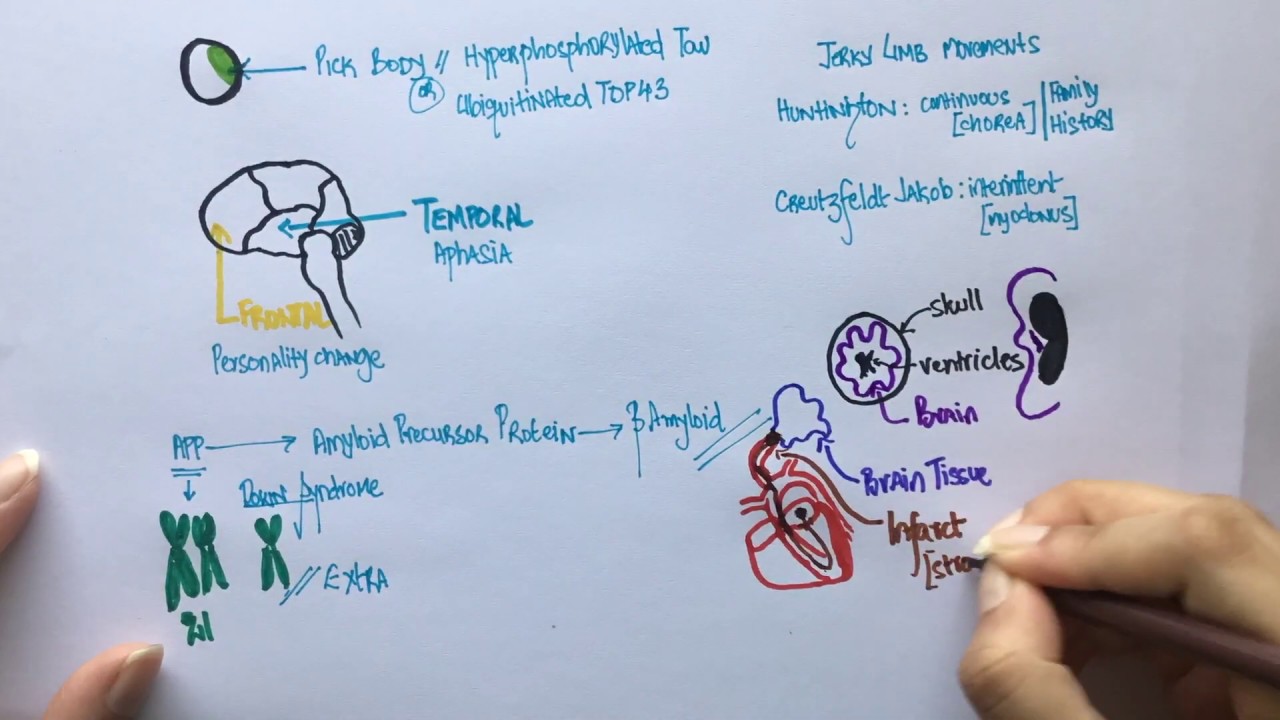 How to diagnose different types of Dementia: Quiz | USMLE